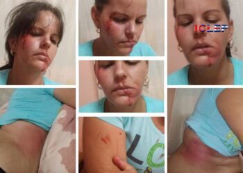 Hecho en comunismo: brutal golpiza y allanamiento de vivienda a periodista independiente