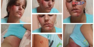 Hecho en comunismo: brutal golpiza y allanamiento de vivienda a periodista independiente