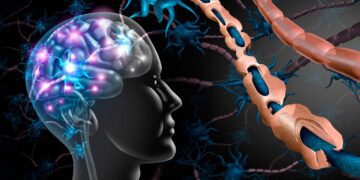 Esclerosis múltiple ¿qué tipo de enfermedad es y cuáles son sus síntomas?