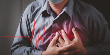 Taquicardia en la caviarada por Cerrón, infarto en sus medios