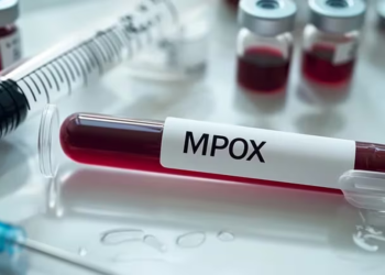 ¿La alerta mundial por la viruela del mono debe preocuparnos o no?