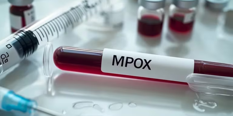¿La alerta mundial por la viruela del mono debe preocuparnos o no?